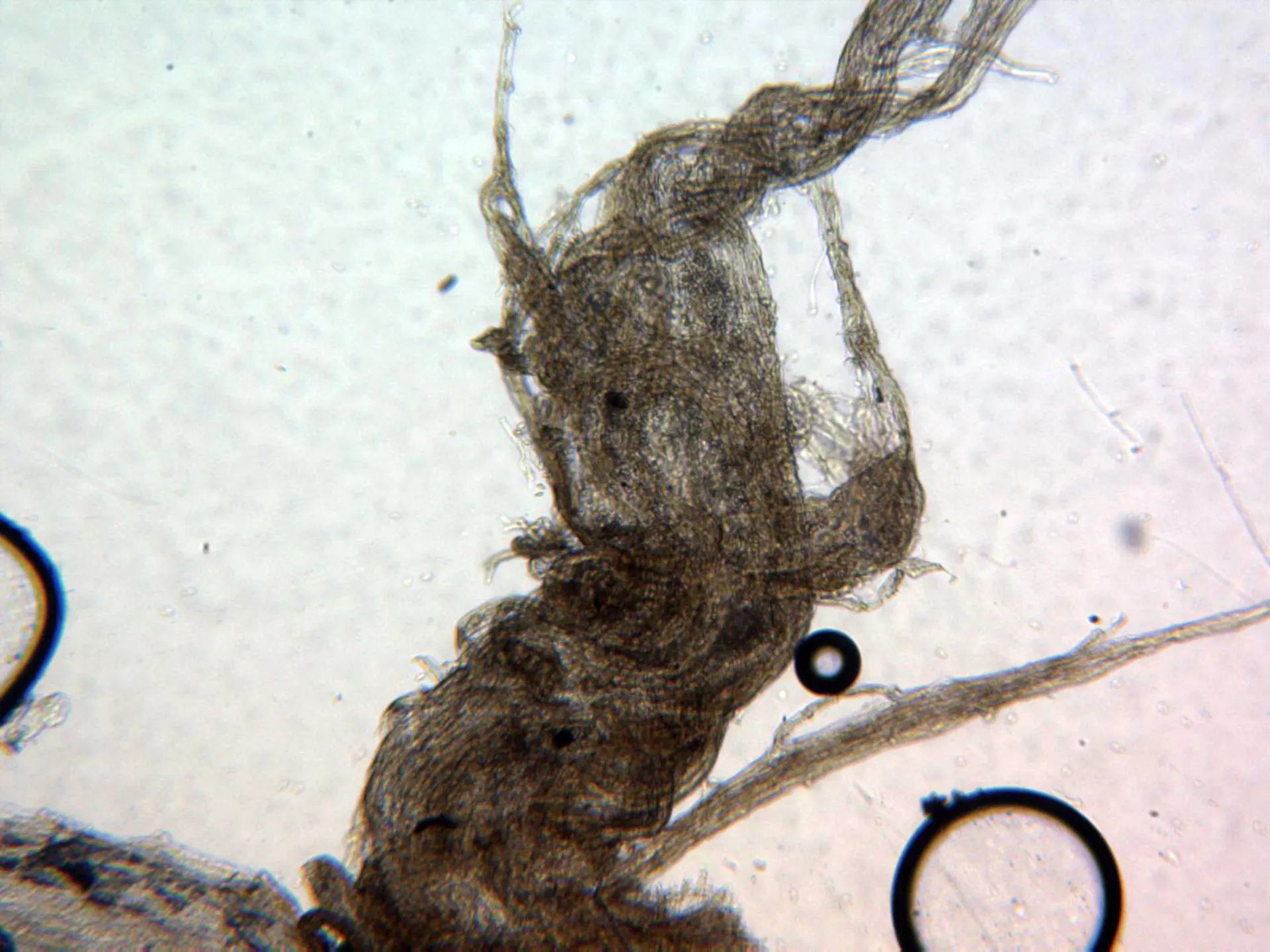 Microscopía de Lentinus tigrinus - 20 - Escama x 100